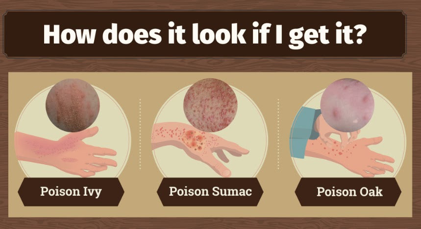 What To Do If You Touch Poison Ivy, Oak, or Sumac